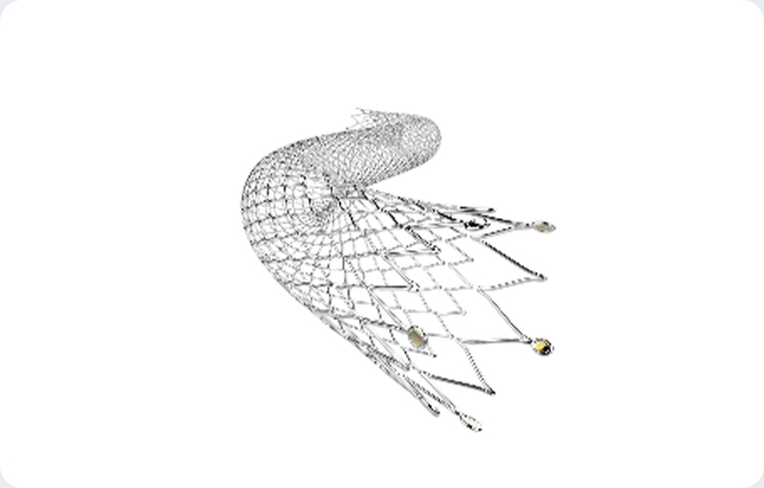 Peripheral Stent System