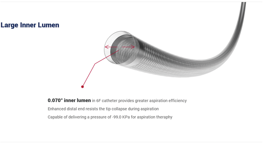 Cylone™ Aspiration Catheter