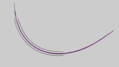 Indications of ZENFlow™ II PTA Balloon Catheter