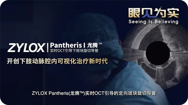 Pantheris Animation- Atherectomy Device Removing Plaque from Peripheral Artery Disease. PML0290 F
