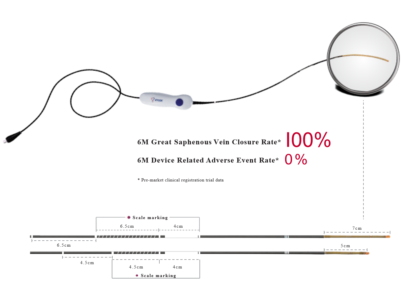 zylox-swan-endovenous-radiofrequency-ablation-catheter-features.png zylox-swan-endovenous-radiofrequency-ablation-catheter-features.png