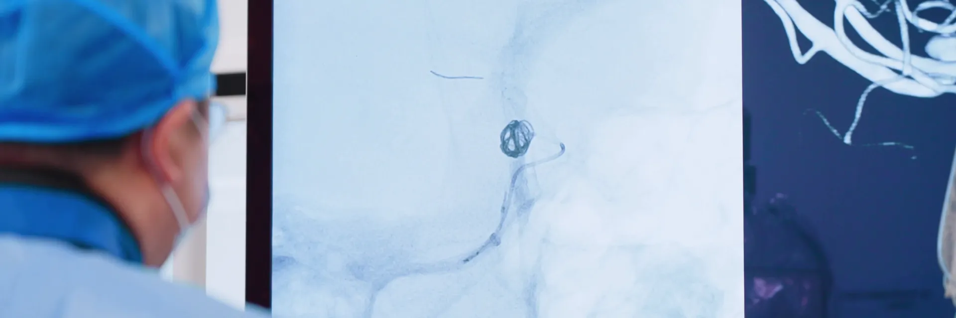 Neurovascular Cases