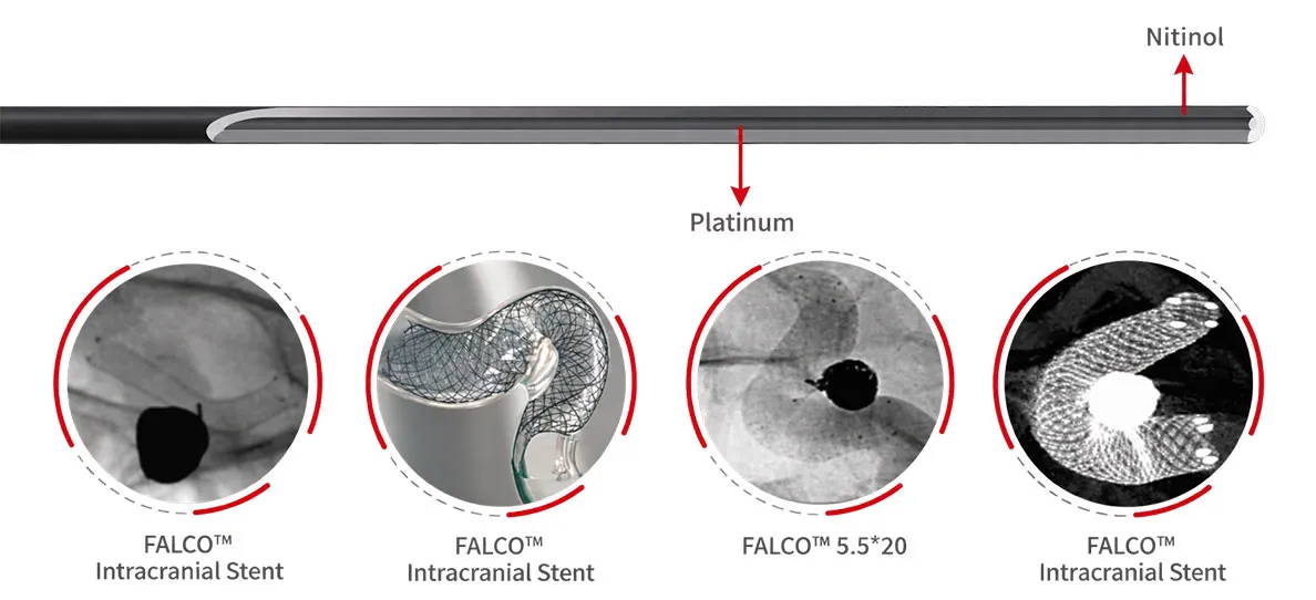 Braided with DFT(platinum-cored nitinol)alloy wires for full-strand radiopacity